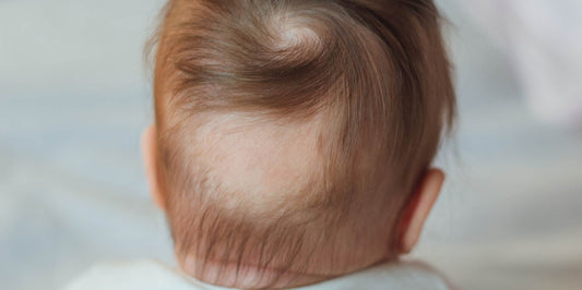 Ultimate Guide to Preventing Baby Bald Spots
