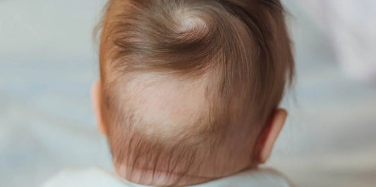 Ultimate Guide to Preventing Baby Bald Spots