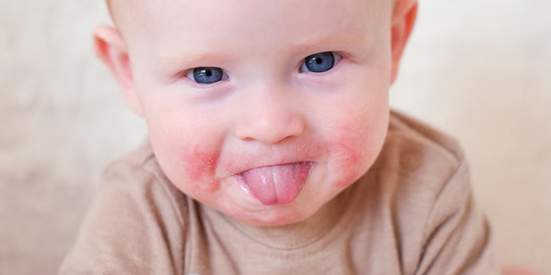 Baby Eczema: Gentle Skincare Tips That Actually Help