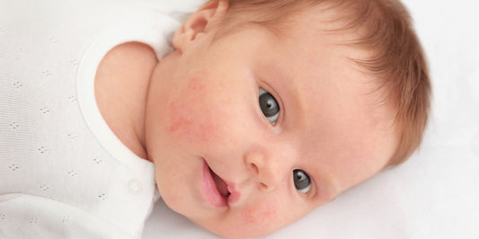Why Does My Baby Have Tiny Red Bumps on Their Face?